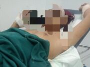 Jurnalis Dibacok Kepalanya Oleh Antek-antek Bos Tambang Kerek Tuban Mediacahayabaru.id Orbitnasional.com Bojonegorotimes.id 101