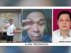 RS Mata Jatim Terseret Kasus Dugaan Kelalaian Medis, Pasien Kehilangan Penglihatan IMG 20260105 WA0015