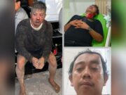 Pengeroyokan Brutal BRN di Pasuruan, Penegakan Hukum Kepolisian Dipertanyakan IMG 20260106 WA0028