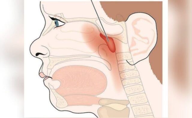 IMG-20260228-WA0028 IMG 20260228 WA0028