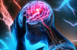 Ini Cara Mudah Menjaga Kesehatan Otak Menurut Dokter Bojonegoro IMG 20260313 WA0035